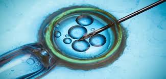 Assisted Reproduction Technology